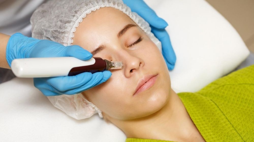 a woman is having a Radio Frequency Microneedling treatment | Feature | Radio Frequency Microneedling Can Help Transform Your Skin | Here's How With Secret RF
